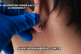 Kulak Deldirdikten Sonra Kaç Gün Su Değmemeli?